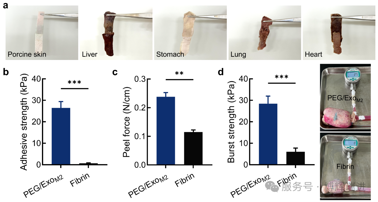 可吸收醫(yī)用膠（博輝瑞進(jìn)）